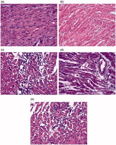Figure 5. Histology of heart sections recovered from rats. (a) Control rat showing normal myocardial syncytial muscle fibers with normal arrangement, nuclei and vasculature of the heart. (b) ISO only rat showing early infarction, widely-dilated engorged blood vessels with areas of extravasation and inflammatory cells infiltration among apparently normal myocardial syncytial muscle fibers. (c) BM-MNC-treated rat showing infiltration with mononuclear (bone marrow) cells. (d) PRAV-treated rat showing apparently normal myocardial muscle fibers, dilated blood vessels and edematous stroma with minimum inflammatory infiltration. (e) PRAV + BM-MNC-treated rat showing bone marrow cells in edematous myocardial stroma with minimal inflammatory infiltration (as compared to the ISO only rats). H&E stain. Magnification = 400×. Representative sections are shown.