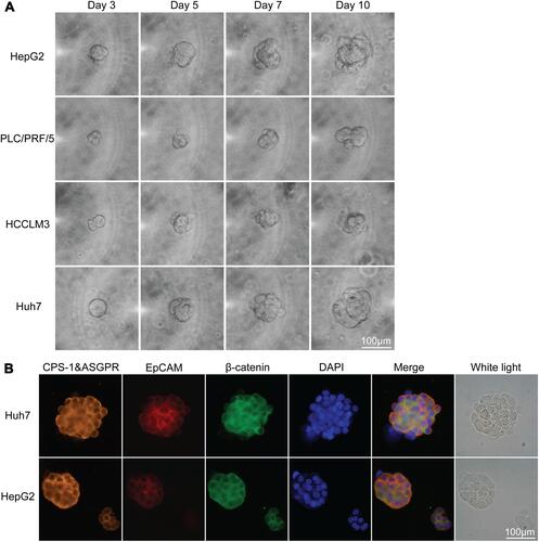 Figure 4 Culture and identification of CTC spheroids from the HCC cell lines. (A) Typical images of CTC spheroids from four HCC cell lines after different periods of culture. (B) Identification of CTC spheroids from HCC cell lines using immunofluorescence analysis.