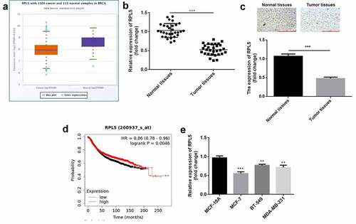 Figure 1. RPL5 was downregulated in breast cancer. (a) RPL5 expression data were acquired from StarBase database. (b) RPL5 mRNA expression was detected in 30 paired tumor tissues and para-carcinoma normal tissues using qPCR. (c) RPL5 expression was detected in tissues using IHC assay. (d) The survival of patients with breast cancer related to RPL5 was acquired from Kaplan online database. (e) RPL5 mRNA expression was evaluated in MCF-7, BT-549, MDA-MB-231 and MCF-10A cells by qPCR. ***P < 0.001. **P < 0.01.