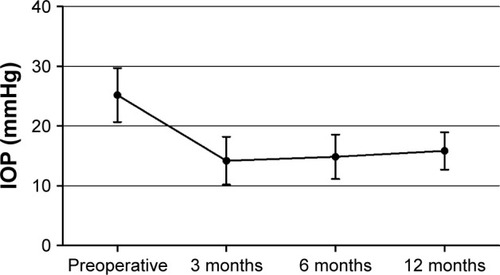 Figure 6 IOP preoperatively and at 3, 6, and 12 months postoperatively.
