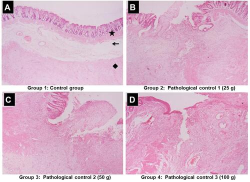 Figure 5 Representative photomicrographs of histopathological changes in the rectal tissue caused by the induction of anal fissure using different weights in anal fissure model.