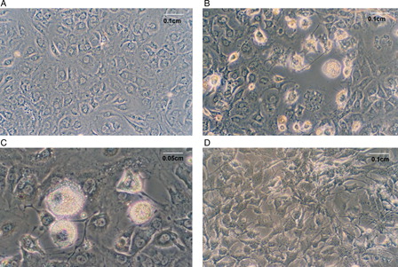 Figure 2. NAC effect on 3T3-L1 cells at day 10 of differentiation. (A) Control cells (CCs), (B) and (C) MDI-treated cells (DCs), (D) MDI + 10 µmol/l NAC-treated cells (DCN). Representative results from one of four independent experiments with similar results are shown.