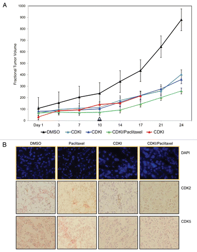 Figure 6 CDK inhibitor treatment of human melanoma xenograft-bearing nude mice. (A) Representative, individual examples of the growth rate of subcutaneous WM983-B MGP melanoma xenografts in nude mice that received the first i.p. injection of the CDK inhibitor (40 mg/kg) (CDKI; light blue-colored line; dark blue-colored line); CDK inhibitor (CDKI) (40 mg/kg) followed 24 hr later by i.p. injection of Paclitaxel (10 mg/kg) (CDKI/Paclitaxel: green-colored line); or only the CDK inhibitor delivery vehicle DMSO (DMSO: black-colored line), on the day (Day 1) a tumor had reached 5 mm in any direction. Subsequent i.p. injections were given on Day 3, 7 and 10. Following the last i.p. injections on Day 10 (indicated by the triangle), tumor volumes in these animals were further recorded on Day 14, 17, 21 and 24. The red-colored line depicts the growth rate of a WM983-B MGP melanoma xenograft in an animal that had been treated i.p. with 40 mg/kg of the CDK inhibitor on Day 1, 3, 7, 10, 14 and 17. (B) CDK2 and CDK5 immunohistochemical analysis of tissue sections prepared from WM983-B MGP melanoma xenografts that until Day 10 had been injected with only DMSO or only Paclitaxel, the CDK inhibitor (CDKI), or the CDK inhibitor combined with Paclitaxel (CDKI/Paclitaxel). Images of the fluorescent DAPI-stained or hematoxylin-counterstained and CDK2 or CDK5-stained tumor sections are depicted at 40X and 20X magnification, respectively.