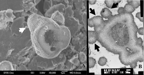 Figure 3 Electron microscopic images of SF-CNP. (A) SEM of an empty apatite “igloo” detached from the culture medium. (B) TEM section of a similar SF-CNP and its inner structure. Arrows point to the apparently budding side of the shell. Bars: (A) =1 μm; (B) = 500 nm.Abbreviations: SEM, scanning electron microscopy, SF-CNP, serum-free calcifying nanoparticles; TEM, transmission electron microscopy.