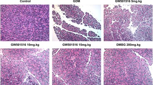 Figure 4 GW501516 improved the damaged islet tissue in GDM rats. Histopathological changes of rat islet tissue were detected by HE staining. n=3.