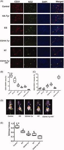 Figure 5. Tumor vasculature and hypoxia after treatment. (A) Fluorescence images of tumors showed CD31-positive endothelial cells (red), NG2-positive pericyte (green), DAPI-positive cell nucleus (blue), and merged images (yellow) photographed (×400). (B) Quantification of CD31-positive tumor vessels. (C) Quantification of the percentage of NG2 showed pericytes were increased during regression of endothelial cells in tumors. Data are expressed as means ± SD (n = 6). ES/HA-Tyr compared with control, HA-Tyr, and ES, respectively. ES/HA-Tyr + RT compared with control, ES/HA-Tyr, and RT, respectively. *p < .05, p < .05. (D) Representative images of the mice after the last treatment. (E) The SUVmax value of ROI in tumors. ES/HA-Tyr + RT compared to control, ES, ES/HA-Tyr, and RT, respectively. Data are expressed as means ± SD (n = 5). *p < .05, **p < .01. CD31, Platelet endothelial cell adhesion molecule-1; DAPI, 4′,6-diamidino-2-phenylindole; NG2, chondroitin sulfate proteoglycan 2. SD: standard deviation.