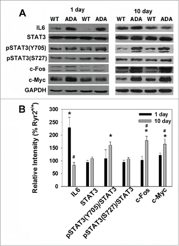 FIGURE 1. IL-6 and downstream signaling molecule expression in hearts of Ryr2+/+ and Ryr2ADA/ADA mice. (A) Immunoblots of heart homogenates from 1-day old and 10-day old Ryr2+/+ (WT) and Ryr2ADA/ADA (ADA) mice. Glyceraldehyde-3-phosphate dehydrogenase (GAPDH) was the loading control. (B) Relative protein and phosphorylation levels in 1-day old and 10-day old Ryr2ADA/ADA compared to Ryr2+/+ mice. Data are the mean ± SEM of 5–19 samples. *p < 0.05 compared to Ryr2+/+, #p < 0.05 compared to corresponding 1 day sample using one way ANOVA.