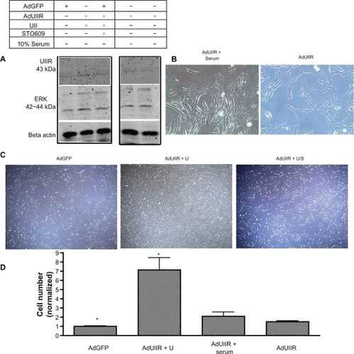 Figure 9 Overexpression of the urotensin II receptor in the presence of urotensin II enhances ERK phosphorylation and cellular proliferation in Pac1 cells. A)A representative immunoblot demonstrates that the Ad-urotensin II receptor in the presence of urotensin II, induces ERK phosphorylation in Pac1. B) A representative image of proliferating Pac1 were taken of Ad-urotensin II receptor + serum, Ad-urotensin II receptor, (image 40 × objective) and C) Ad-GFP, Ad-urotensin II receptor + urotensin II, Ad-urotensin II receptor + urotensin II + STO609 (image 20 × objective). D) Cellular proliferation determined by cell counting in Pac1, measures Ad-urotensin II receptor in the presence of urotensin II (n = 2, P ≤ 0.01).