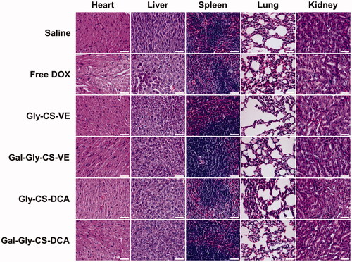 Figure 9. H&E staining of major organs of mice treated by DOX and DOX-loaded chitosan nanoparticles for 11 days, scale bar = 50 μm.