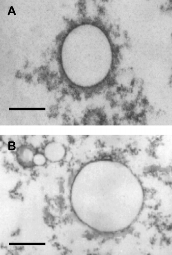 FIG. 2 Transmission electron micrographs of cationic liposomes. A = MS10; B = MS11. Bar = 100 nm.