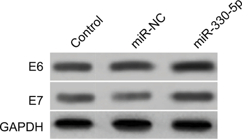 Figure S2 SiHa cell was transfected with miR-NC or miR-330-5p, and the expression of HPV E6 and HPV E7 were detected using Western blotting assay.