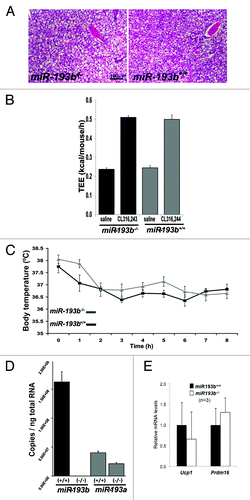 Figure 2. Brown adipose (BAT) development and function are unaffected by the absence of miR-193b/365-1. (A) H&E staining of BAT from two-month-old control (miR-193b+/+) and miR-193b/365-1 mutant (miR-193b-/-) males. (B) Effect of the β3 adrenergic agonist CL 316 243 on total energy expenditure in miR-193b+/+ and miR-193b-/- in two-month-old male mice (data are presented as mean +/− SEM (n = 6 mice/group). (C) Body temperature in two-month-old miR-193b+/+ and miR-193b-/- male mice exposed to 4°C for the indicated period of time. Values are mean ± SEM (n = 6). (D) Copy number of miR-193b and miR-193a per ng of total RNA isolated from BAT of two-month old miR-193b+/+ and miR-193b-/- mice. Values are mean ± SD (n = 3).