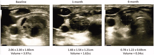 Figure 2. The ultrasound images obtained at baseline, 1-month and 6-month.