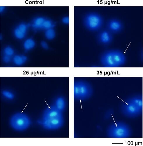 Figure S2 Effect of TBMS1 on U87 cell apoptosis.Notes: Cells were exposed to TBMS1 at the indicated concentrations for 24 hours, then stained with Hoechst 33258. The nuclei were observed using a fluorescence microscope. Arrows indicate chromatin condensation and apoptotic bodies.Abbreviation: TBMS1, Tubeimoside-1.