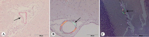 Figure 2 Congo red staining of the brain of aged dogs: (A) amyloid in the wall of meningeal blood vessel (arrow), frontal section; (B) amyloid in the wall of meningeal blood vessel (arrow), frontal section, under the polarized light; (C) amyloid in the wall of meningeal blood vessels of cerebellum (arrow), under polarized light.