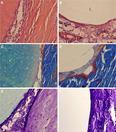 Figure 5 The HE, Masson, and toluidine blue staining.Notes: (A, C, E) in the experimental group and (B, D, F) control group at 2 weeks postoperative (×200).Abbreviation: HE, hematoxylin and eosin.