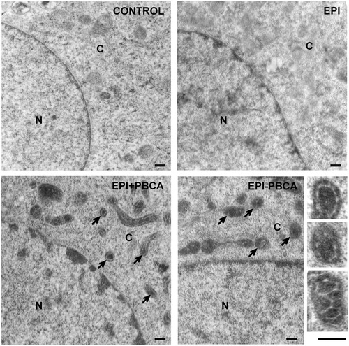 Figure 5. TEM images of untreated HeLa cells (control) and HeLa cells treated with free EPI, EPI + PBCA or EPI − PBCA formulations. Arrows indicate PBCA nanoparticles in endosomal/lysosomal vesicles. Insets represent single vesicles. Labels: N, nucleus; C, cytoplasm. Scale bar: 200 nm.