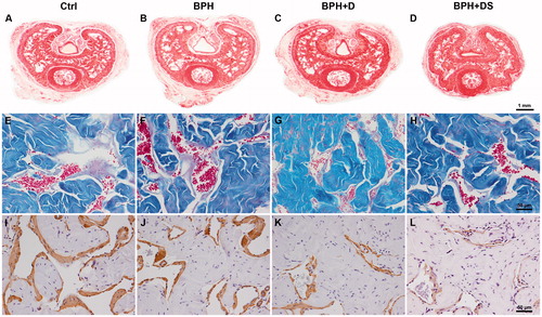 Figure 1. Penile histological sections of control and BPH rats with dutasteride or dutasteride and sildenafil treatment. Images A, B, C, and D were stained by Picrosirius red, captured under 20× magnification, and used for assessing the areas of the penis, corpus cavernosum (including its tunica albuginea), and the corpus cavernosum without the tunica albuginea. Images E, F, G, and H were stained by Masson’s trichrome, captured under 400× magnification, and used for assessing the connective tissue and sinusoidal space surface densities. Images I, J, K, and L were immunolabeled with anti-alpha-actin antibodies, captured at 400× magnification and used for assessing the smooth muscle surface density. Ctrl: control group, composed of Wistar Kyoto rats (images A, E, and I); BPH: group of benign prostatic hyperplasia models (images B, F, and J); BPH + D: group of BPH models receiving dutasteride (images C, G, and K); BPH + DS: group of BPH models receiving dutasteride and sildenafil (images D, H, and L).