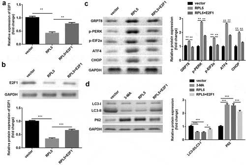 Figure 7. RPL7/E2F1 axis regulated ERS and autophagy in breast cancer cells. (a) The expression of E2F1 was evaluated by qPCR. (b) The expression of E2F1 was evaluated by western blotting. (c) Protein levels of ERS markers were measured by western blotting. (d) Protein levels of autophagy markers were measured using western blotting. **P < 0.01. ***P < 0.001.