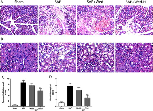 Figure 5. Effects of Wed treatment on the pancreatic and kidney histological abnormalities in rats following SAP. Representative images of kidney and pancreas sections stained with H&E (original magnification, ×200). (a) Pancreas pathology; (b) kidney pathology; (c, d) pancreatic and renal tissue pathological grades. The data are presented as the mean ± SD (n = 5). **p < 0.01 vs. the Sham group; &&p < 0.01 vs. the SAP group.