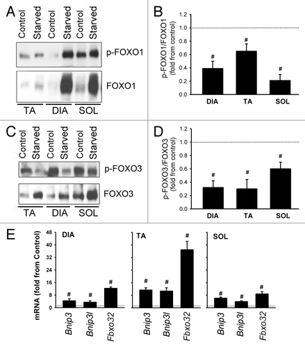Figure 11. Expression and phosphorylation of FOXO1 and FOXO3 in response to starvation. (A) Representative immunoblots of total and phosphorylated (Ser256) FOXO1 in DIA, TA, and SOL muscles of control and acutely starved mice. (B) Protein optical densities of total and phosphorylated (Ser256) FOXO1 in DIA, TA, and SOL muscles of control and acutely starved mice. Values (means ± SEM) are expressed as fold change relative to control group. #P < 0.05, as compared with control. n = 6 per group. (C) Representative immunoblots of total and phosphorylated (Ser253) FOXO3 in DIA, TA, and SOL muscles of control and acutely starved mice. (D) Protein optical densities of total and phosphorylated (Ser253) FOXO3 in DIA, TA, and SOL muscles of control and acutely starved mice. Values (means ± SEM) are expressed as fold change relative to control group. #P < 0.05, as compared with control. n = 6 per group. (E) mRNA expression of three targets of FOXO transcriptional activities (Bnip3, Bnip3l, and Fbxo32) in DIA, TA, and SOL of acutely starved mice. Values (means ± SEM) are expressed as fold change relative to control group. #P < 0.05, as compared with control. n = 6 per group.