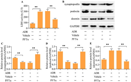 Figure 4. The inhibition of p53 relieved ADR-evoked podocyte injury. (A) The effect of p53 inhibition on ADR-evoked podocyte injury was monitored by measuring LDH activity. (B-E) The effect of p53 inhibition on synaptopodin, podocin and desmin levels in ADR-stimulated podocytes was examined by Western blotting. n = 3, **p < 0.01.