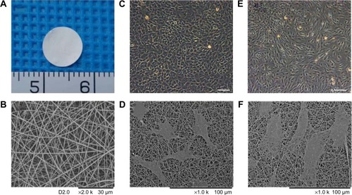 Figure 1 Characterization and biocompatibility of GT/PCL nanofibrous membrane.Notes: (A) Gross view of the sheet of electrospun GT/PCL nanofibrous membrane. (B) SEM image of GT/PCL membrane. (C) Morphology of Passage 1 chondrocytes using a light microscope. Scale bar: 200 μm. (D) Morphology of chondrocytes on GT/PCL membranes after 2 days of cell culture in vitro. (E) Morphology of Passage 2 BMSCs using a light microscope. Scale bar: 200 μm. (F) Morphology of BMSCs on GT/PCL membranes after 2 days of cell culture in vitro.Abbreviations: GT/PCL, gelatin/polycaprolactone; SEM, scanning electron microscopic; BMSC, bone marrow stromal cell.