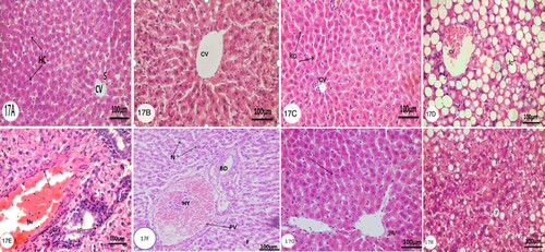 Figure 1. Photomicrographs of transverse section (T. S) (5 µm) of liver of rats of control group, HP-administered group, OLZ-administered group, and animal treated with OLZ and HP. Characteristic ﬁgures were stained with H&E. The original magniﬁcation was x100. (A and B) Control group, Arrow, (CV) and (S) indicate normal hepatic cell, central vein, and sinusoids, respectively. (C) Animals treated with 81.0 mg/kg /day HP three times a week for 4 weeks. Illustrating normal Kupffer Cells (KC) lining the sinusoids. (D, E, and F) animals treated with 27.0 mg/kg/day OLZ daily for 6 weeks showing severe fatty changes (FC) and dilated congested central vein (CV) hyperemic dilated portal vein (HY), bile duct (BD) and necrotic cells (N). In addition to inflammatory cells infiltration (IF) in the portal areas and dilated portal vein (pv) with arrow refers to swelling endothelium. (G and H) rats were given OLZ at a dose of 27.0 mg/kg/day for 6 weeks plus with HP at a dose of 81.0 mg/kg/day three times a week for last 4 weeks revealing normal hepatic parenchyma indicated by an arrow without fatty changes and dilated portal vein (PV).