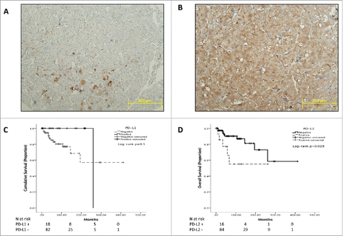 Figure 1. Representative sections of PCC/PGL TMA cores. Panel (A)shows focal expression of PD-L1 in a malignant case and the diffuse pattern of immunopositivity typical of PD-L2 immunostaining (Panel B). Panel (B) highlights the specificity of PD-L2 staining for PCC/PGL cells where sustentacular cells are negative for PD-L2 expression. Panels C and D show Kaplan-Meier curves describing the overall survival of patients with PCC/PGL categorized according to PD-L1 (Panel C) and PD-L2 (Panel D).