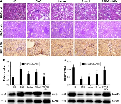 Figure 10 Histological H&E staining, PAS staining and IHC of FN in kidney, magnification ×400 (A). The expression of TGF-β1 (B) and Smad2/3 (C) in kidney was evaluated by Western blotting. *P < 0.05 vs DNC group, **P < 0.01 vs DNC group. PPP-RH-NPs, RH-loaded PEG-PCL-PEI nanoparticles.Abbreviations: DN, diabetic nephropathy; DNC, DN control; FN, fibronectin; HC, healthy control; H&E, hematoxylin and eosin; IHC, immunohistochemistry; PAS, periodic acid–Schiff; PEG-PCL-PEI, polyethyleneglycol-co-polycaprolactone-co-polyethylenimine; RH, rhein; RH-sol, RH solution.