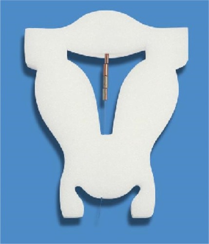 Figure 1 The small GyneFix® 200 IUD (Contrel Research, Ghent, Belgium) is shown inserted in a foam uterus.