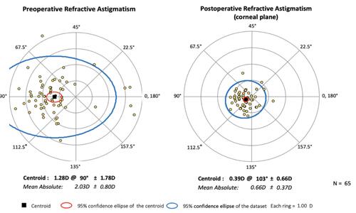 Figure 3 Preoperative and three month postoperative refractive astigmatism (n=65, D diopters).