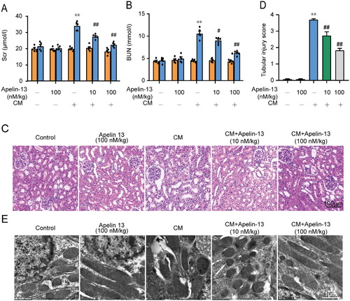 Figure 3. The protective effects of apelin-13 on renal function and pathological injury in rat kidneys. We observed the changes of SCr, BUN, and renal histopathology changes through HE staining in the control group, 100 nM apelin-13 group, iohexol group, iohexol + 10 nM apelin-13 group and iohexol + 100 nM apelin-13 group. (A) Changes of SCr level. (B) Changes of BUN level. (C) Representative images of HE staining. Scar bar, 100 μm. (D) Histopathological score of tubular damage. (E) Representative images of transmission electron microscope analysis (original magnification: ×5000, ×20000; scar bar: 1 μm; under a Hitachi H7700 electron microscope). *p < 0.05, **p < 0.01, significantly different from control group; #p < 0.05, ##p < 0.01, significantly different from the CM group. All quantitative data are expressed as means ± SEMs, n = 5.