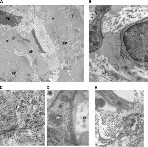 Figure 12 Examples of ultrastructure observed when comparing the treated versus untreated side.