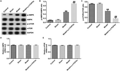 Figure 5. AMPK/mTOR pathway in liver tissues from CLP-treated rats. (A) Protein expression of AMPK, p-AMPK, mTOR and p-mTOR. (B) Quantified results of p-AMPK. (C) Quantified results of p-mTOR. (D and E) mRNA levels of AMPK and mTOR evaluated using qRT-PCR. **p < 0.01 vs. Sham; ##p < 0.01 vs. Model.