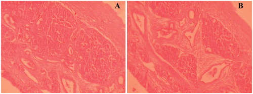 Figure 3.  Light photomicrograph of sheep nasal mucosa, untreated control mucosa (a) and drug-loaded SLN formulation treated mucosa (b).
