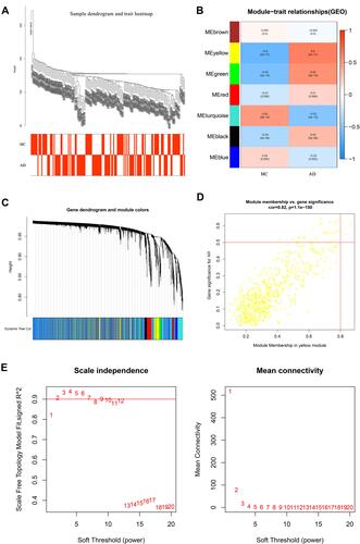 Figure 2 WGCNA of AD dataset (GSE5281). (A) The sample dendrogram and trait heatmaps. (B) Heatmap showed the relationships between different modules and clinical traits, each row presented a module eigengene, column to a trait. Each cell represented the correlation between module eigengenes (rows) and traits (columns), and the corresponding P value.7 modules were related to AD. (C) Dendrogram of all differentially expressed genes of AD was clustered based on the measurement of dissimilarity. The color band showed the results obtained from the automatic single-block analysis. (D) Module membership in yellow module. (E) Analysis of network topology for various soft‐thresholding powers, a soft threshold of 1 was the most suitable value to AD. The abscissa of the picture represented soft‐thresholding power.