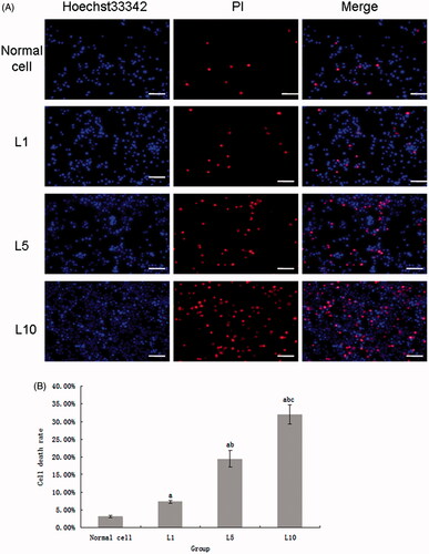 Figure 3. The cell death rate detected with Hoechst33342/PI. (A) The death cells untreated or treated with lidocaine hydrochloride (Hoechst33342/PI, 20×, bar = 50 µm). PI indicated the death cells, Hoechst33342 staining indicated the nucleus and the merged image was the combination of those two pictures (normal cells: untreated with lidocaine hydrochloride; L1: cells treated with 1 mM lidocaine hydrochloride for 24 h; L5: cells treated with 5 mM lidocaine hydrochloride for 24 h; L10: cells treated with 10 mM lidocaine hydrochloride for 24 h). (B) The death cells rate analysis (mean ± sd, n = 6), ap < .05 versus normal cells, bp < .05 versus cells in L1 group L1; cp < .05 versus cells in group L5.