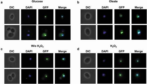 Figure 3. CgTOG1 is localized to the nucleus. Fluorescence of L5U1 C. glabrata cells harboring the pGREG576_MTI_CgTOG1 plasmid after 5 h of copper-induced recombinant protein production in BM-U medium. (a,b) Cells were washed with PBS buffer and transferred to YP medium with glucose or oleate as carbon source for 1 h. (c,d) Cells were washed with PBS buffer and transferred to fresh medium with or without 15 mM H2O2 for 1 h. Results indicate that CgTog1_GFP fusion protein localized to the nucleus under all conditions tested. The displayed images are representative of at least three independent experiments