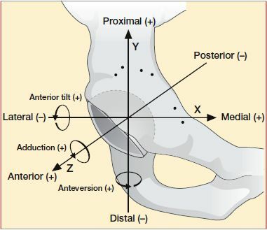 Figure 2. Illustration of directions, translation, and rotations for Avantage DM cup.