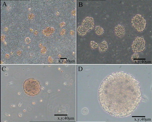 Figure 1. Floating neural spheres generated from hippocampal in serum-free medium. (A) and (C) were primary culture. (B) and (D) were secondary culture. (A) 10 μm, (B) 20 μm, (C) 40 μm and (D) 80 μm.