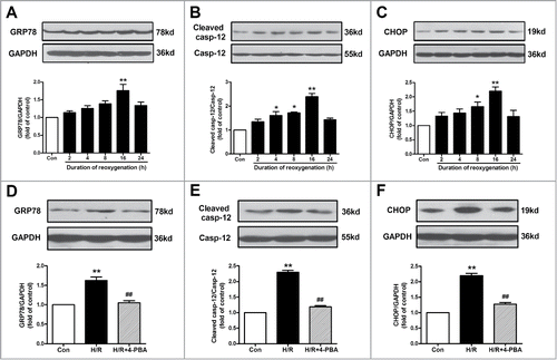 Figure 1. ER stress-associated apoptosis was involved in H/R-induced endothelial injury. (A-C) Cell lysates from HUVECs were immunoblotted with antibodies of GRP78, caspase-12 and CHOP with different reoxygenation time course. (D-F) Protein expression of GRP78, caspase-12 and CHOP in endothelial cells treated with an ER stress inhibitor 4-PBA (10−4 M) in the context of H/R. GAPDH served as internal control. Open bar, normoxia; filled bar, H/R. The data expressed as mean ± SEM in each bar graph represent the average of 4 independent experiments. *P < 0.05 and **P < 0.01 vs Con; ##P < 0.01 vs H/R.