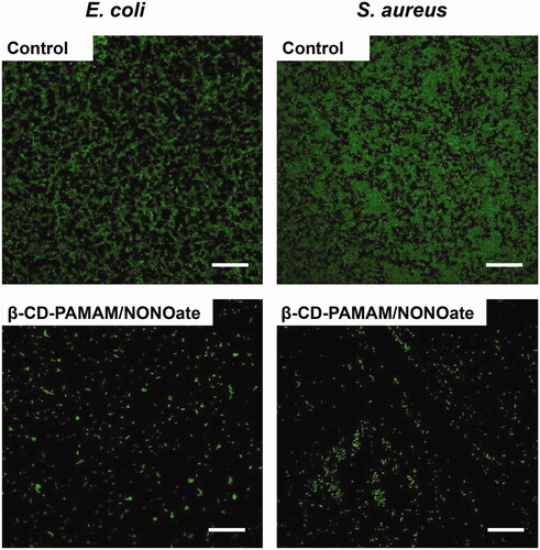 Figure 5. Fluorescence images of E. coli (A) and S. aureus (B) biofilms stained by SYTO-9 after treated with or without 25 μg/mL β-CD-PAMAM/NONOate for 12 h (scale bar represents 50 μm).