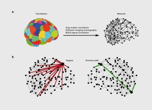 Figure 1. Construction of brain networks from magnetic resonance imaging datasets and characterization of brain-network hubs. A) Brain networks are constructed by parcellation of the whole brain into nodes, and by definition of structural or functional links between these nodes. This procedure reduces the original data into a network model suitable for topological analysis (for clarity long-range connections are omitted from the present visualization). B) Measures of network centrality are most commonly based on the degree (the number of links between a node and other nodes in the network) and on the length of shortest paths (the smallest number of links connecting a pair of nodes). Hubs connect to many other nodes (in red) and have high degree. Hubs are also within close topological reach of other nodes (green path) and have a high closeness centrality or nodal efficiency. Finally, hubs lie on many short paths between other pairs of nodes (circles on green path) and have a high betweenness centrality.