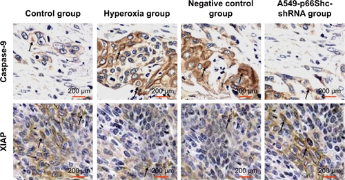 Figure S2 The expressions of XIAP and caspase-9 proteins in A549 cells by immunohistochemical method (± S, n=5).