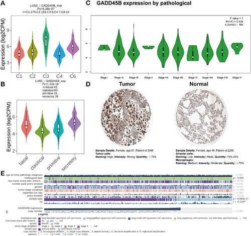 Figure 5. GADD45B expression in LUSC. (A) GADD45B expression in different TISIDB-derived LUSC immune subtypes. (B) GADD45B expression in different TISIDB-derived LUSC molecular subtypes. (C) GADD45B expression in different GEPIA2-derived LUSC stages. GADD45B gene expression data were calculated relative to log counts per million mapped reads (log2 CPM) in (A, B) and log2 (TPM + 1) in (C). (D) HPA-based immunohistochemistry of GADD45B. GADD45B in normal tissue: https://www. proteinatlas.org/ENSG00000099860-GADD45B/tissue/lung; GADD45B in tumour tissue: https://www.proteinatlas.org/ENSG00000099860-GADD45B/pathology/lung+ cancer#img. T: GADD45B pcarotein expression in cancer samples (high staining, strong intensity, quantity >75%); N: GADD45B protein expression in non-carcinoma samples (low staining, weak intensity, quantity 75%-25%). (E) GADD45B mRNA expression is correlated with the histological and sample types (n = 758).