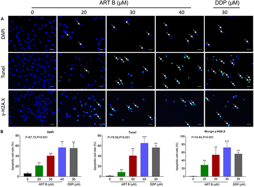 Figure 6 In vitro pro-apoptotic effects of ART B on H1299 cells for 24 h. (A) DAPI, TUNEL, and γ-H2A.X immunofluorescence observations of H1299 cells after 24 h treatment of ART B (0, 20, 30, and 40 μM) or DDP (30 μM). White arrows in the top row indicate the abnormal shape of the nucleus, white arrows in the middle row indicate apoptosis positive cells, and white arrows in the bottom row indicate γ-H2A.X positive cells. (B) Statistical data. Data are presented as mean ± SD (n = 3), **P < 0.01, and ***P < 0.001 vs control group. Scale bar: 50 μm.