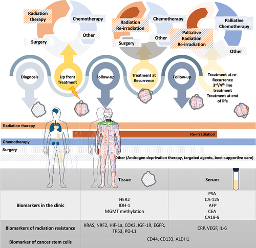 Figure 2. Oncologic management modalities and their concurrent utilization over the course of malignancy illustrate the evolution of management components (surgery, radiation, systemic management) and existing biomarkers utilized in the clinic in relation to sample acquisition [Citation4,Citation5].
