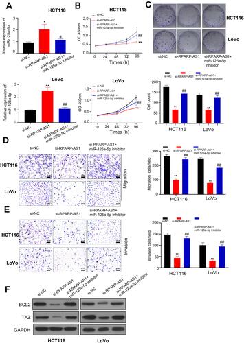 Figure 4 RPARP-AS1 sponged miR-125a-5p to regulate tumor cell proliferation, migration or invasion. (A) miR-125a-5p expression increased in si-RPARP-AS1 cells which partially decreased by miR-125a-5p inhibitor in HCT116 and LoVo cell lines. (B) The proliferation of si-RPARP-AS1 cells decreased than that of si-NC groups which partially increased by miR-125a-5p inhibitor in HCT116 and LoVo cell lines. (C) Colony formation assay showed that siRPAPR-AS1 cells formed fewer clones than si-NC cells which partially increased by miR-125a-5p inhibitor in HCT116 and LoVo cell lines. (D) TransWell (without Matrigel) showed that knockdown of RPARP-AS1 decreased the migration ability of HCT116 and LoVo cells which was partially recovered by miR-125a-5p inhibitor. (E) TransWell (with Matrigel) showed that knockdown of RPARP-AS1 decreased the invasion ability of HCT116 and LoVo cells which partially increased by miR-125a-5p inhibitor. (F) Western blot showed that knockdown of RPARP-AS1 decreased the expression of BCL2 and TAZ which partially increased by miR-125a-5p. (*P-value < 0.05, **P-value < 0.01, compared with si-NC; #P-value < 0.05, ##P-value < 0.01, compared with si-RPARP-AS1).