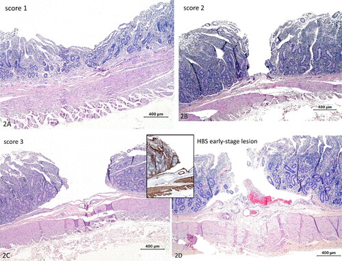 Figure 2. Histological scoring of abrasive lesions created with the ex vivo intestinal mucosal abrasion model. (a) Score 1, depression of the mucosa. Hematoxylin and eosin (HE). (b) Score 2, mucosal cleavage in the propria no dissection of the lamina muscularis mucosae (LMM) (HE). (c) Score 3, mucosal cleavage with dissection of the LMM. (d) Early-stage lesion in a cow with hemorrhagic bowel syndrome. Histologically very similar to score 3, with erosion and dissection of the LMM. Inset: this LMM splitting is even more clear with smooth muscle actin immunohistochemistry. Hemorrhage is evidently only apparent at the early-stage lesion (HE). Magnification = bar.